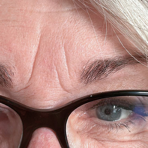 Close-up before photo of woman with black glasses having taken The Solution, Oslo Skin Lab's collagen powder. Her name is Brit