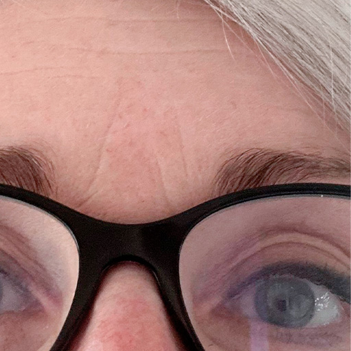 Close-up after photo of woman with black glasses having taken The Solution, Oslo Skin Lab's collagen powder. Her name is Brit.