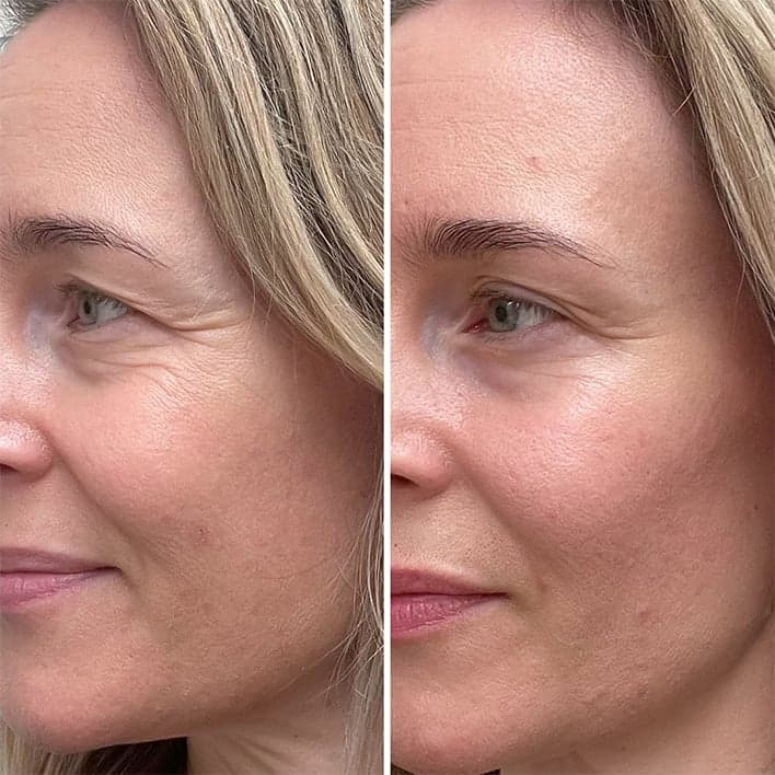 Before & After Charlotte